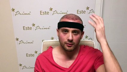 TURKEY HAİR TRANSPLANT -SAÇ EKİMİ