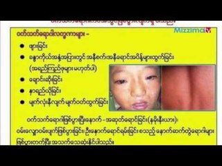ဝက္သက္ေရာဂါအျဖစ္မ်ားေန၍ ရန္ကုန္ရိွ ၿမိဳ႕နယ္ငါးခုတြင္ ကာကြယ္ေဆးထိုးေပးေန