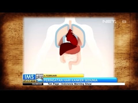 IMS - Today's History 4 Februari - Hari Kanker Sedunia