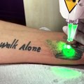Serdivan lazer dövme silme adapazarı