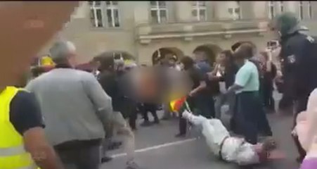 Alman Polisi Copla PKK'lı Teröristin Kafasını Yardı