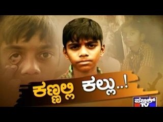 Public TV | Special Time: ಕಣ್ಣಲ್ಲಿ ಕಲ್ಲು..! | October 6th, 2016