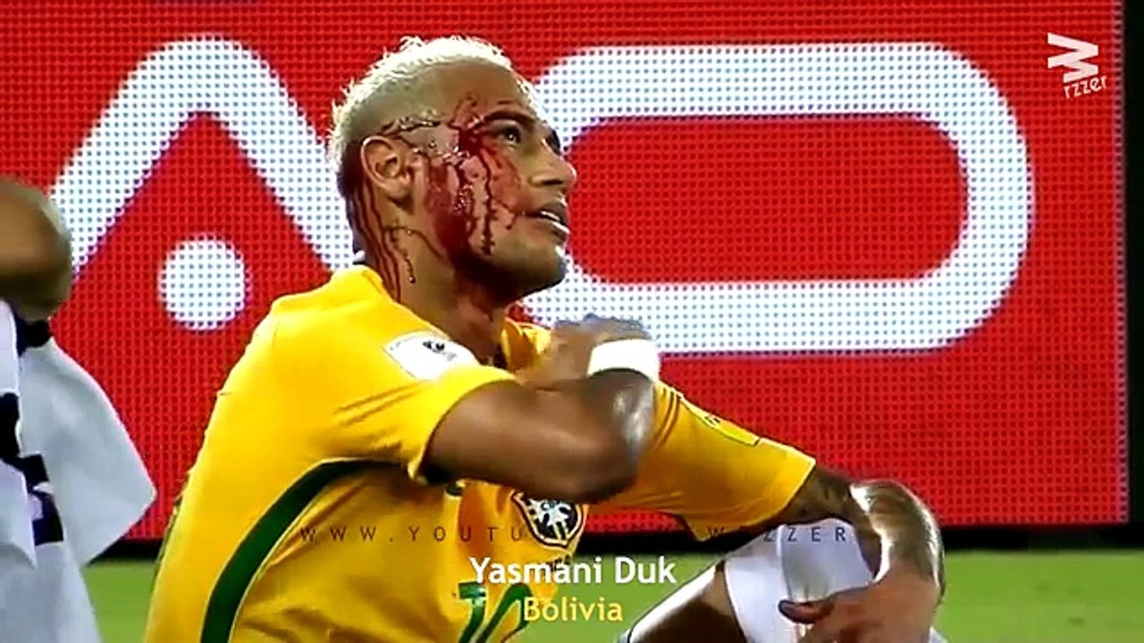 20 Brutal Elbows In Football ● Ouch!