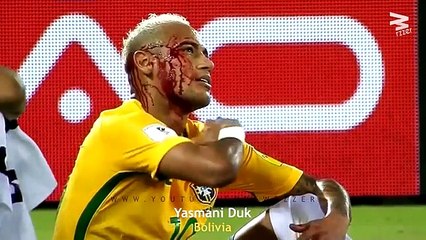 20 Brutal Elbows In Football ● Ouch!