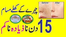 Remove Close Large Pores On Face Remedy