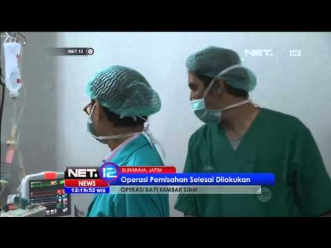 Tim dokter kesulitan menutup luka operasi bayi kembar siam Aldi Aldo - NET12