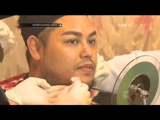 Ivan Gunawan Jalani Treatment Vampire