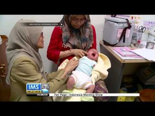 Pencegahan penyakit Polio - IMS