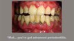 Dentist Health Care - Root Canal Dentist Surgery Gums Treatment