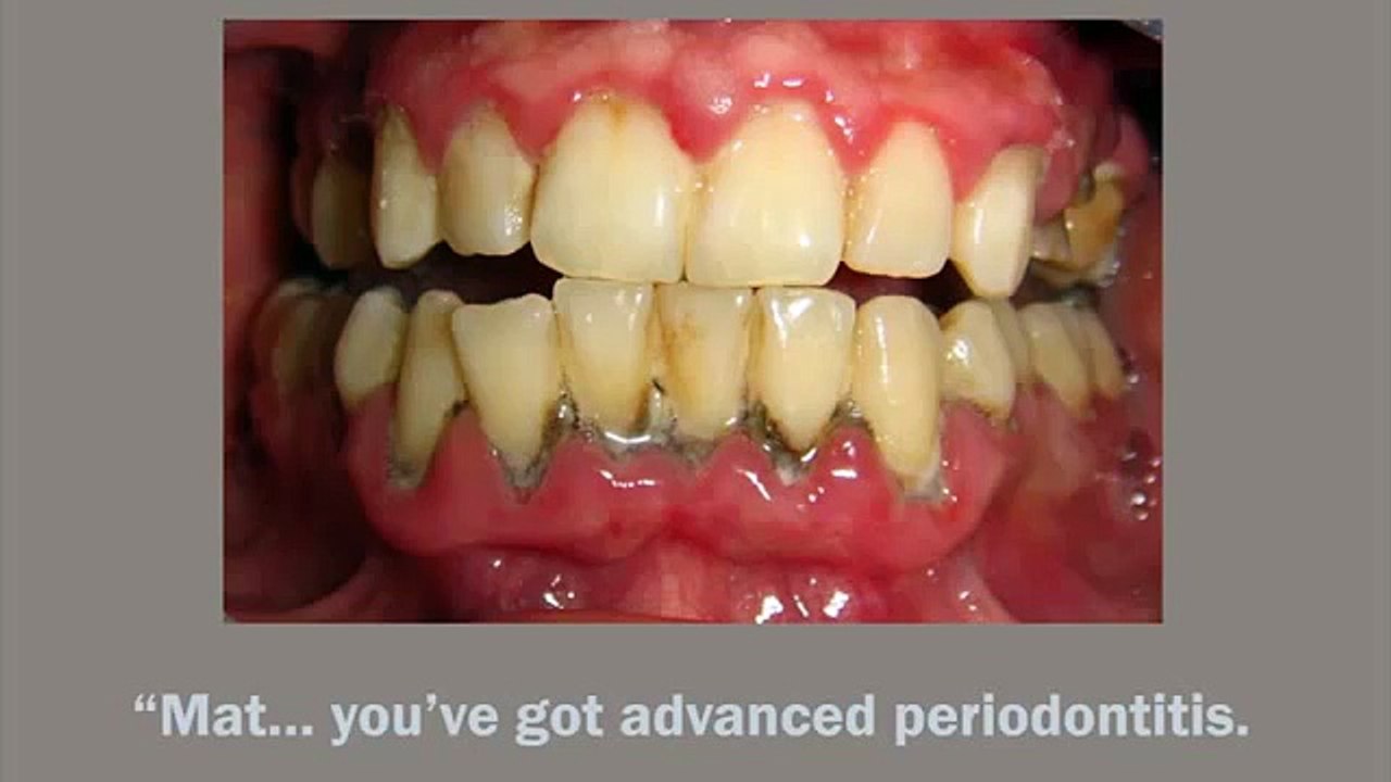 Dentist Health Care - Root Canal Dentist Surgery Gums Treatment