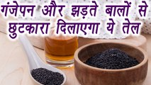 Kalonji Oil, कलौंजी का तेल | Hair Growth | झड़ते बालों से छुटकारा दिलाएगा ये तेल |Boldsky