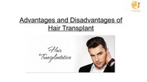 Advantages and Disadvantages of Hair Transplant