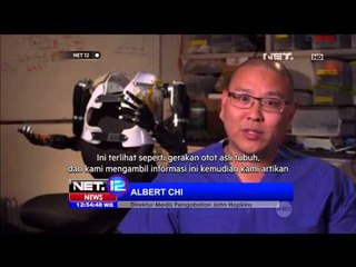 Dengan Lengan Robot Akhirnya Bisa Merasakan Kembali Gerakan Tangan -NET12