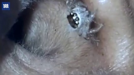 Elle se réveille avec une douleur atroce dans l’oreille. Quand son mari inspecte à l’intérieur, c’est la panique général