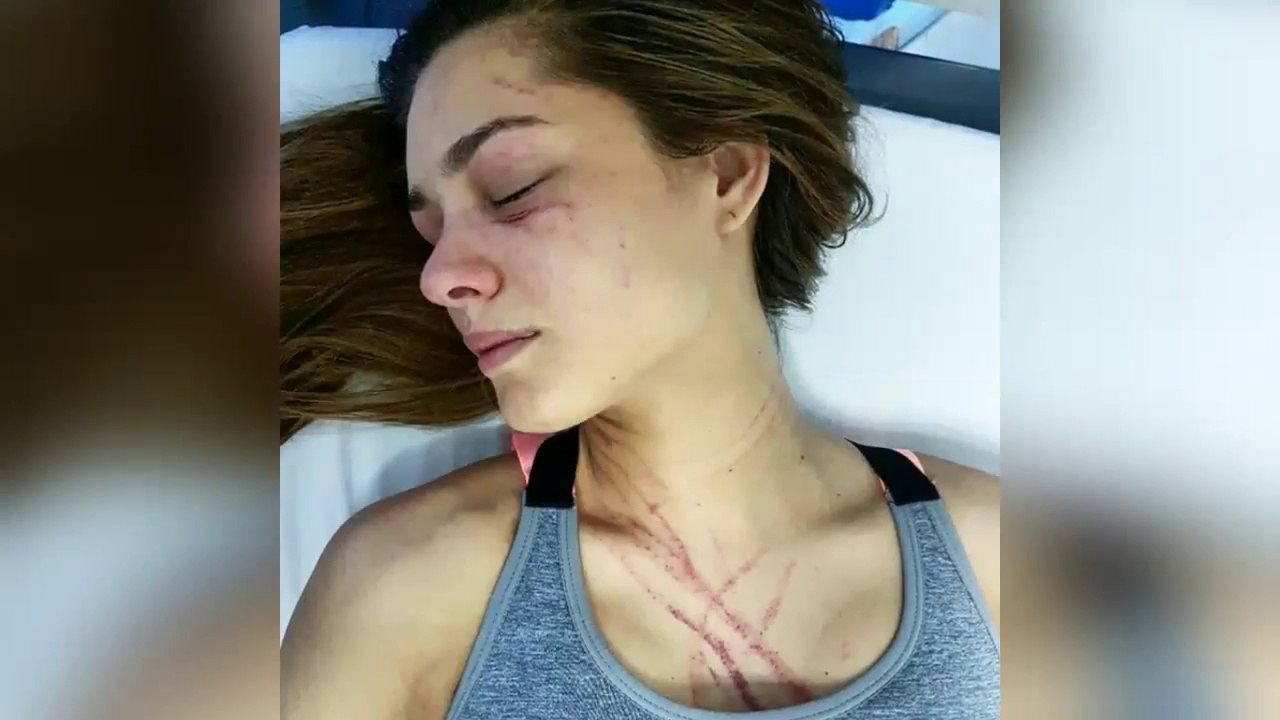 Así Quedo Osmariel Villalobos Tras Recibir Golpiza Por Diosa Canales