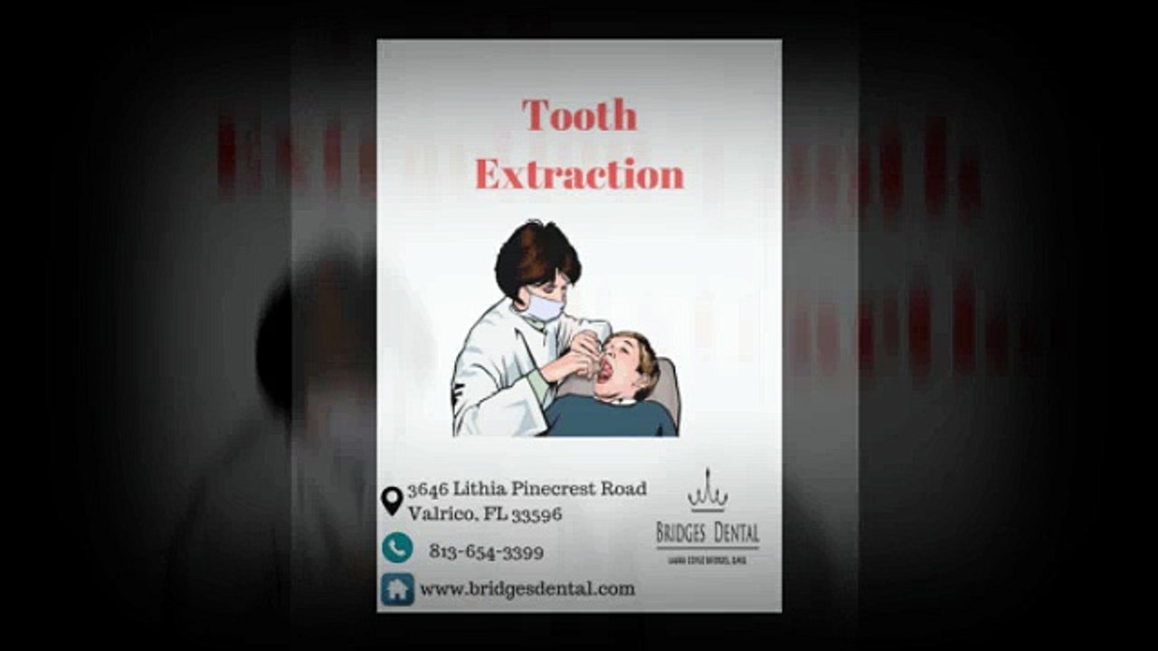 Tooth Extraction : An Optimal Solution for Your Healthy Smile with Brandon Dentist