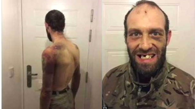 Akilalmaz Iskence Dislerini Cekicle Kirip Kestikleri Cinsel Organini Yedirmisler Dailymotion Video Akilalmaz Iskence Dislerini Cekicle Kirip Kestikleri Cinsel Organini Yedirmisler Dailymotion Video
