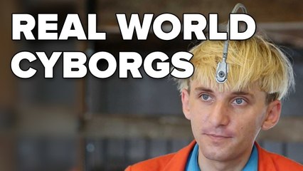 Check Out These Real World Cyborgs