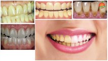 How to Have Natural White Teeth in 2 minutes _ 100% Natural