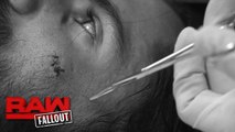 Seth Rollins receives stitches after soaring onto Bray Wyatt- Raw Fallout, June 19, 2017