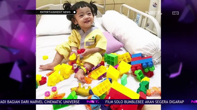 Oki Setiana Dewi Sempat Panik Kedua Anaknya Terkena Campak