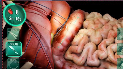 Let's play operate now hospital part 1