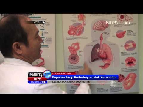 Warga yang Terkena Dampak Kabut Asap Dihimbau Memakai Masker N-95 - NET5