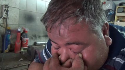 Gözünden Süt Fışkırtan Adam Görenleri Hayrete Düşürüyor