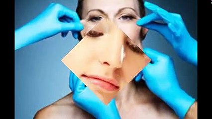 Căng da mặt nội soi phương pháp lấy lại tuổi thanh xuân