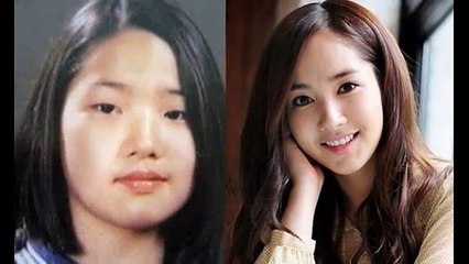 bấm mí dove eyes bao nhiêu tiền - Thẩm mỹ viện Hà Nội