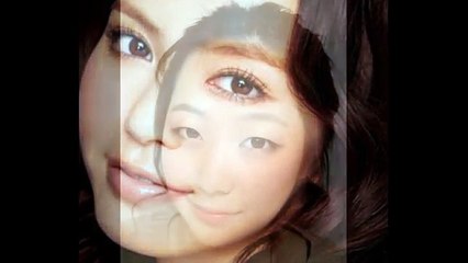 bấm mí dove eyes hà nội - Thẩm mỹ viện Hà Nội