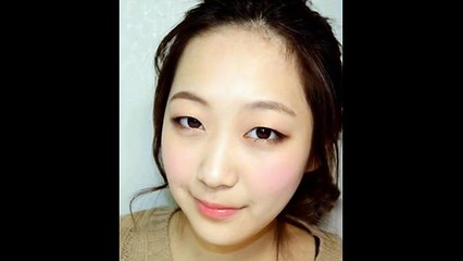 bấm mí dưới - Thẩm mỹ viện Hà Nội