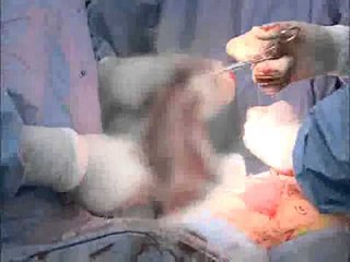 명의 - Best Doctors_5대암 4부 - 유방암 전문의 양정현 교수_#001