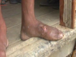 Tears of the forgotten   Interview  ( part  3 )