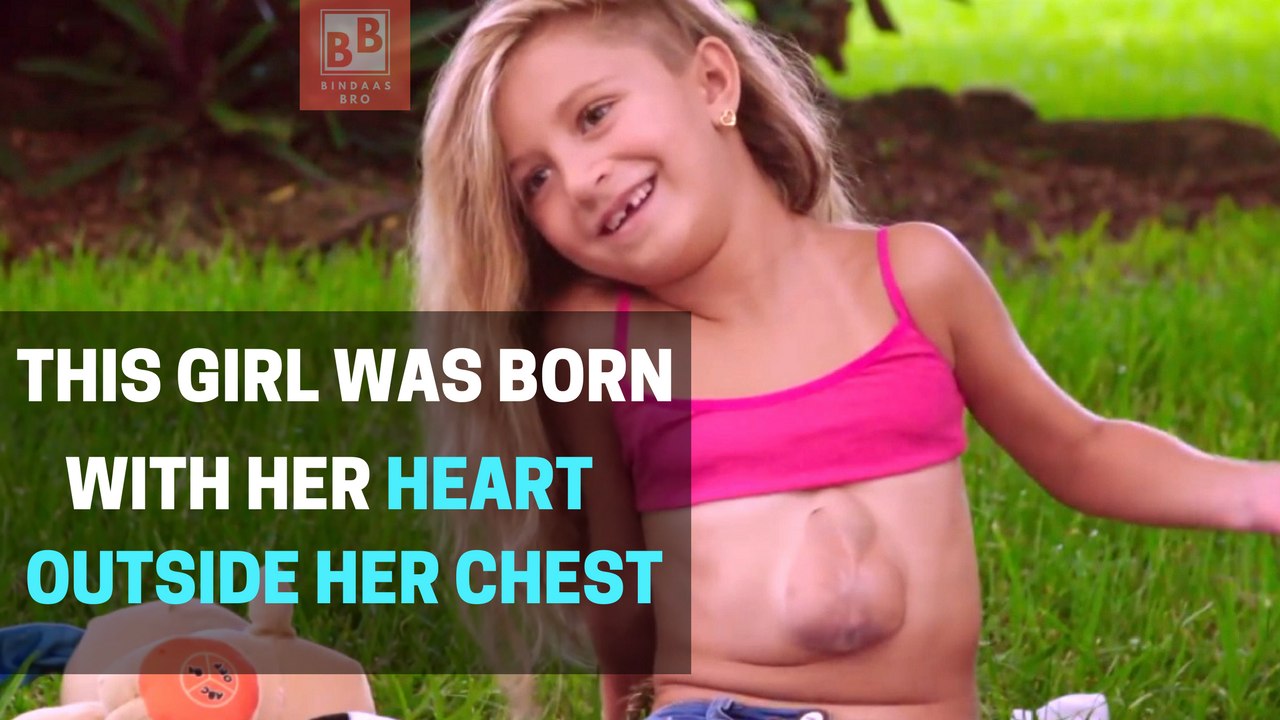 Virsaviya Borun is Born with Her Heart Outside her Chest | BindaasBro