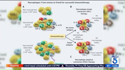 Woman Issues Warning to Others After Battle With Late-Stage Skin Cancer