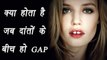 Gap between teeth; Know interesting facts | क्या होता है जब दांतों के बीच हो गैप | Boldsky