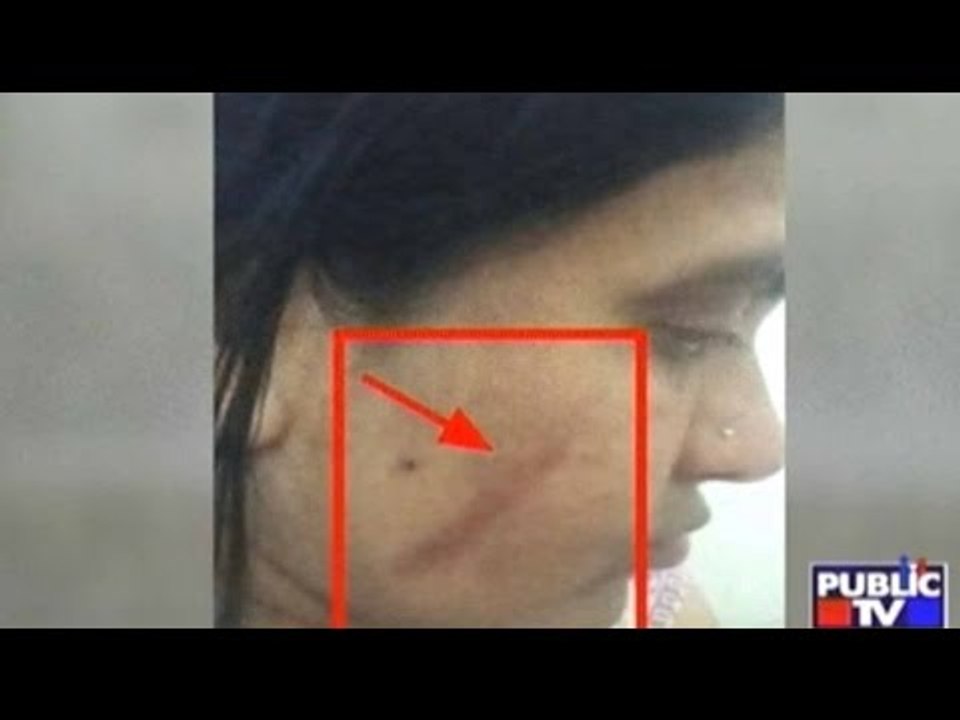 Bangalore: Hebbal Women's Association Head Thra...