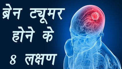 Brain Tumor Symptoms: Must not ignore | ब्रेन ट्यूमर के ये लक्षण कर देंगे हैरान | Boldsky