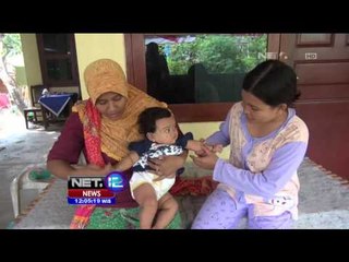 Pasca Imunisasi, Balita Ini Sakit Kulit - NET12