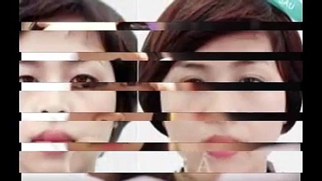 Nhấn mí Hàn Quốc dịch vụ thẩm mỹ không cần phẫu thuật