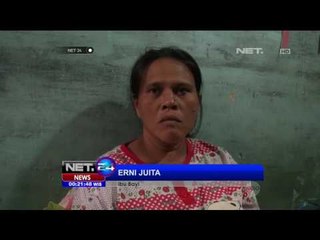 Terlahir Tanpa Batok Kepala - NET 24