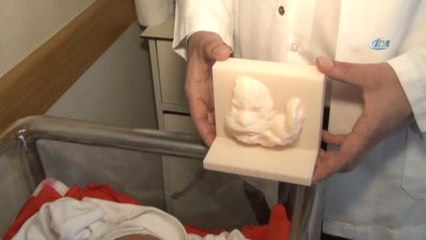 3 Boyutlu Bebek Dünyaya Geldi