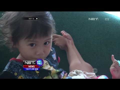 Dua Balita Kembar Siam Asal Sumedang Dirawat di RSUD Sumedang - NET12