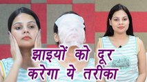 Skin Pigmentation Treatment, झाइयों को  यूं करें दूर | DIY | BoldSky