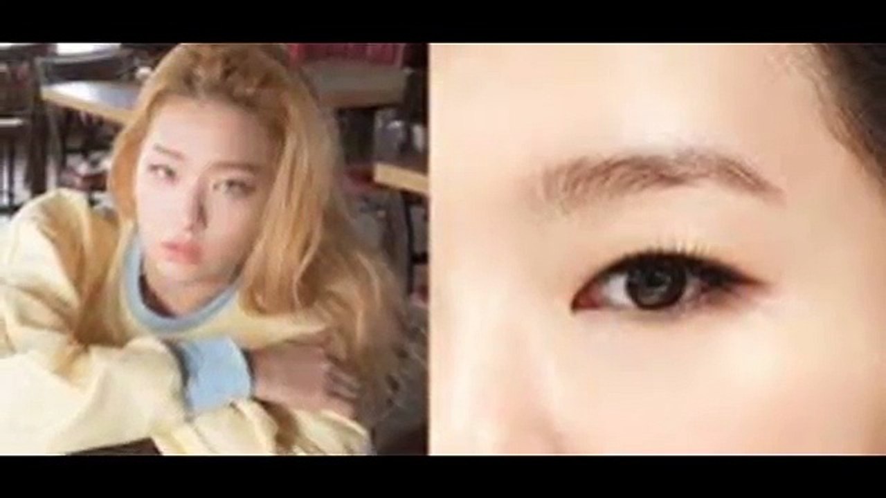 Nhấn mí Hàn Quốc không còn lo về đôi mắt 1 mí