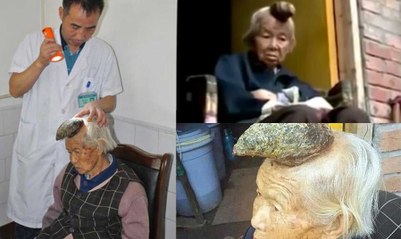 El extraño caso de "la mujer unicornio" en China