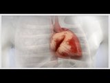 ¿Cómo diferenciar un infarto fulminante?