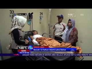 Bocah 12 Tahun Alami Luka Bakar - NET24