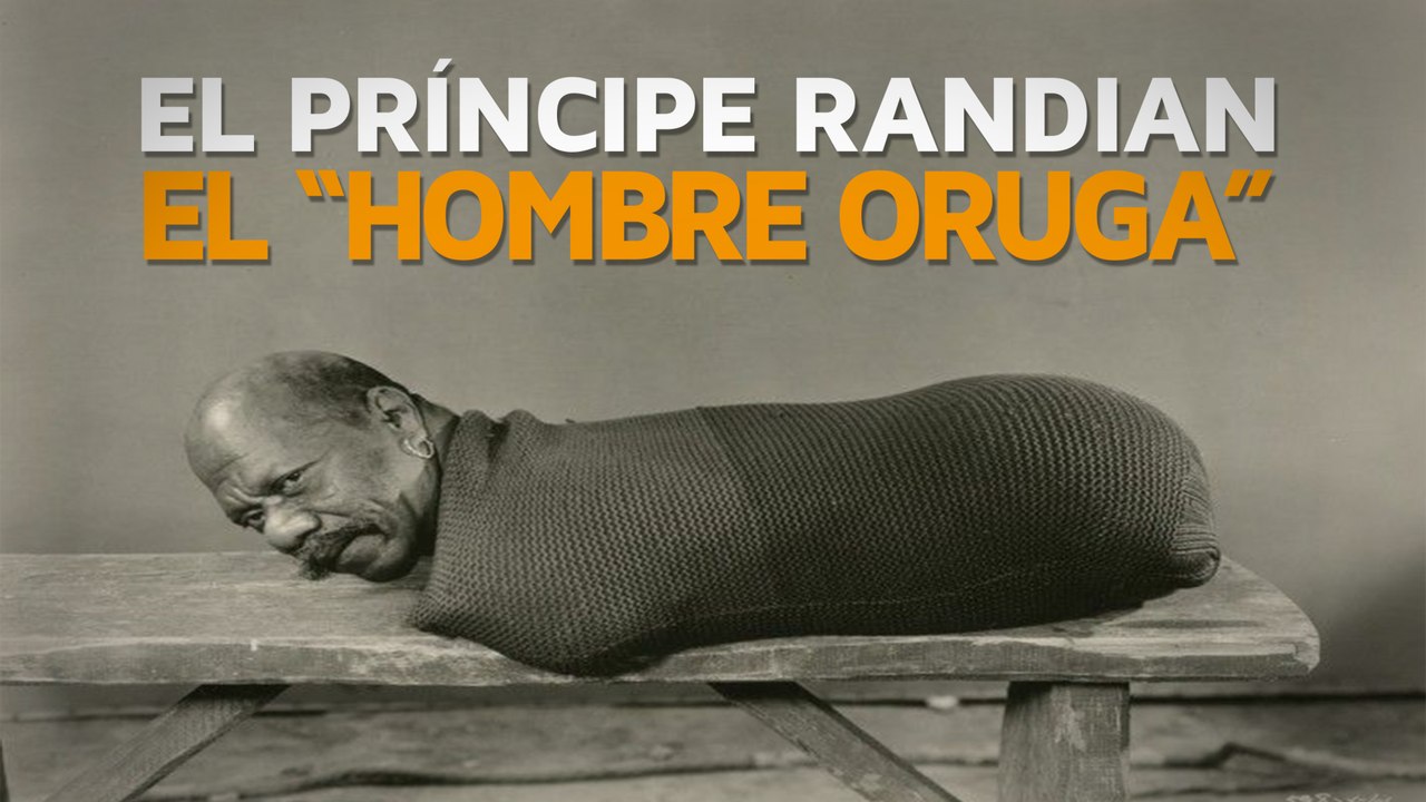El Príncipe Randian, el “hombre oruga”